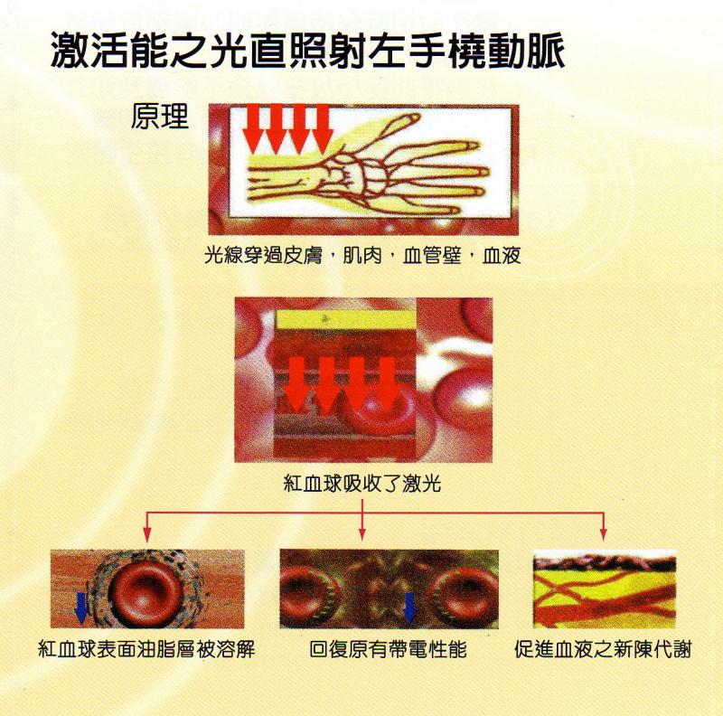 Low Level Laser Treatment Operation